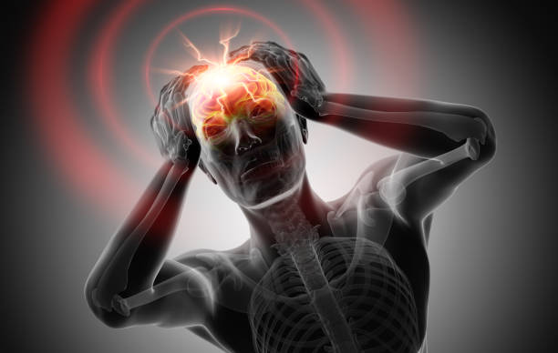 3D render of a man with strong pain in head - Grayscale Image